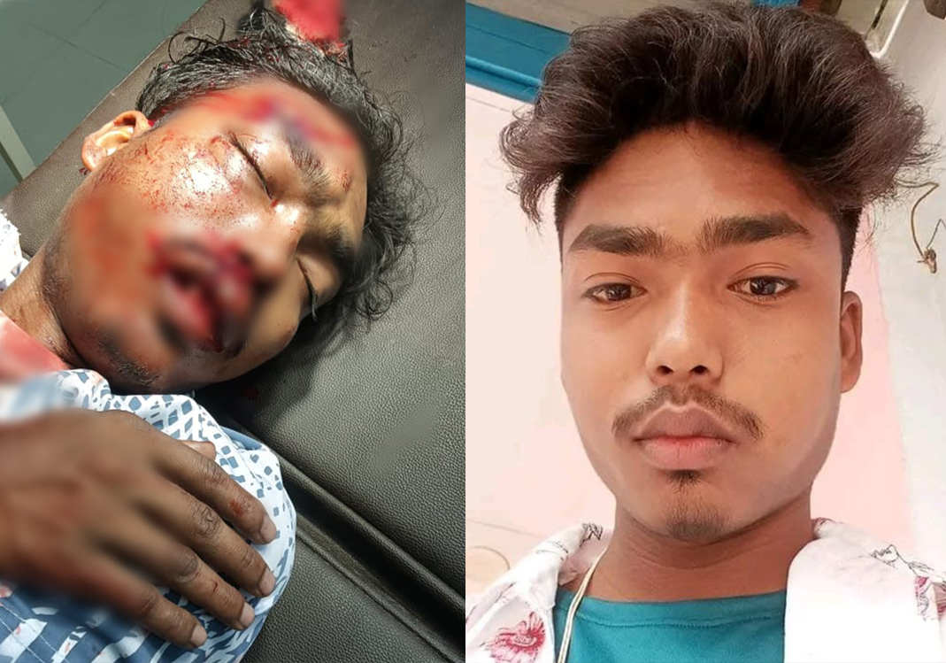 Help Ankur Fight For His Life