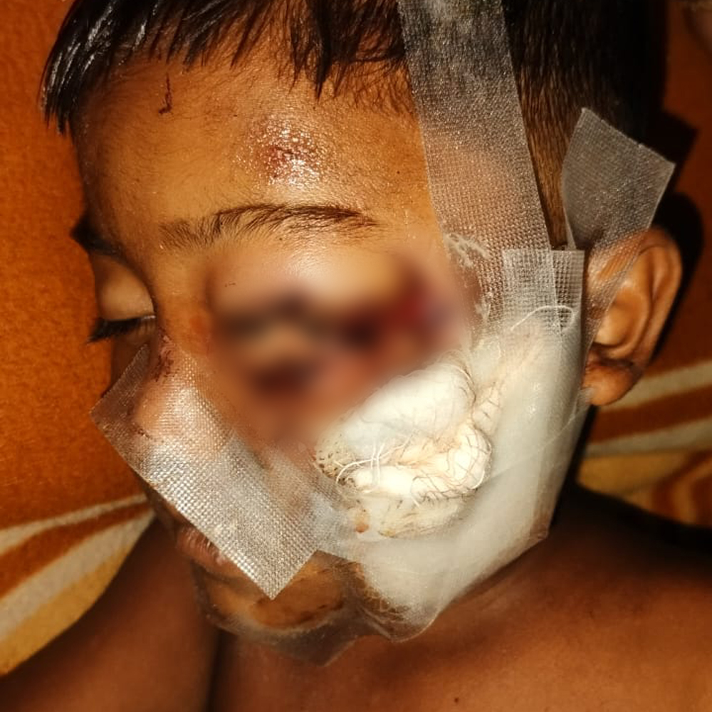 Help 5 Years Old Rinku See the World Again