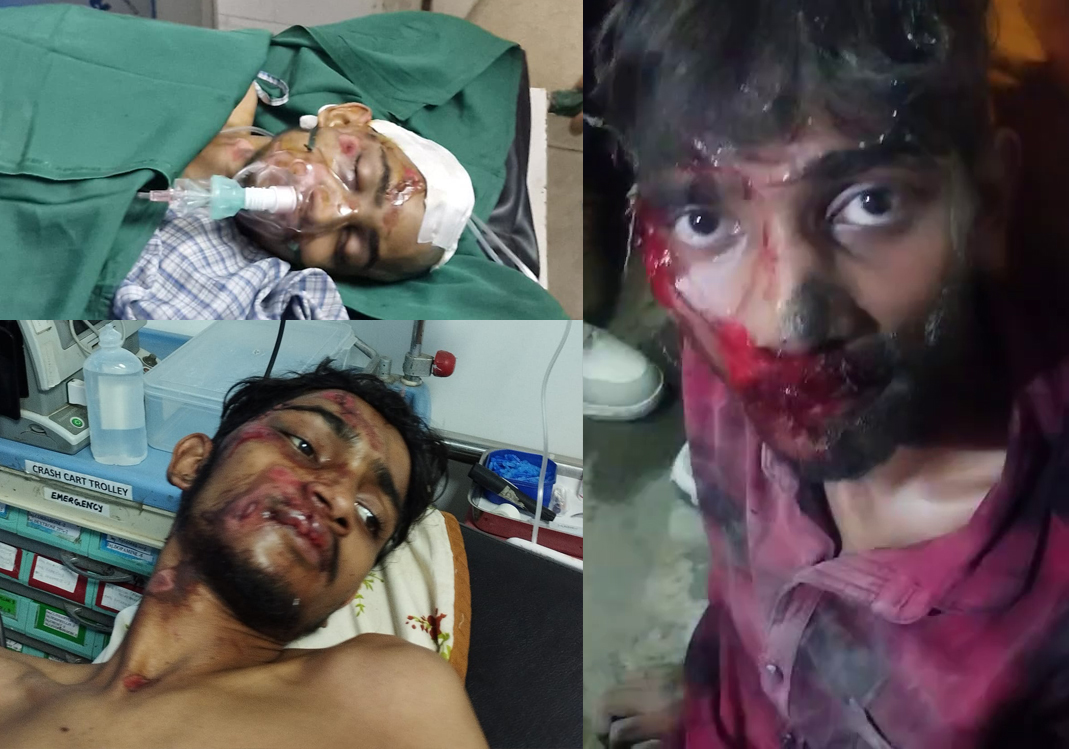 Don't Let Debarshi's Story End Here — Help Him Live Again