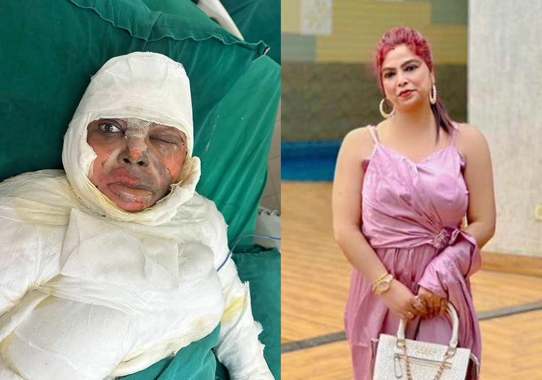 From Tragedy to Hope: Help Popi Kalita Fight for Her Life