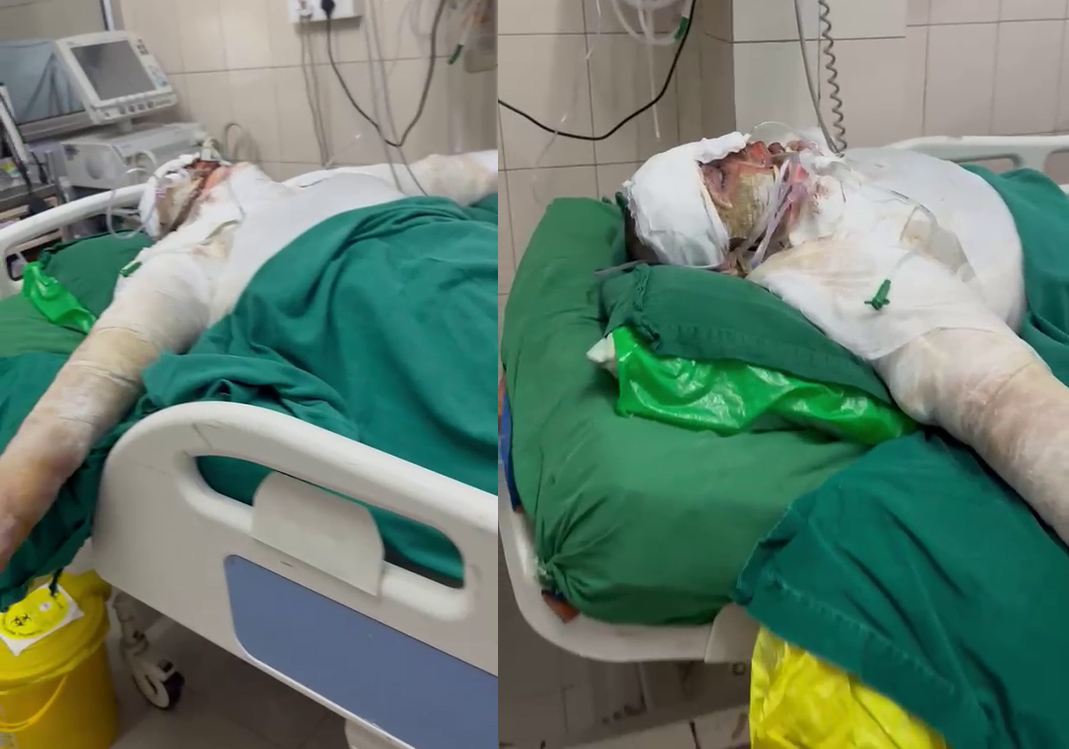 From Tragedy to Hope: Help Popi Kalita Fight for Her Life
