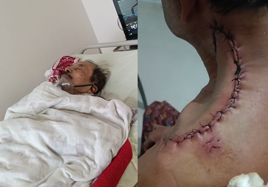 Support Debendra’s Cancer Treatment